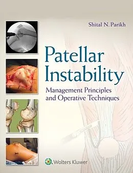 E-Book (epub) Patellar Instability von Shital N. Parikh