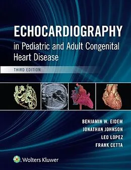 E-Book (epub) Echocardiography in Pediatric and Adult Congenital Heart Disease von Benjamin W. Eidem, Frank Cetta