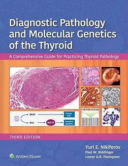 E-Book (epub) Diagnostic Pathology and Molecular Genetics of the Thyroid von Yuri E. Nikiforov, Paul W. Biddinger, Lester D.R. Thompson