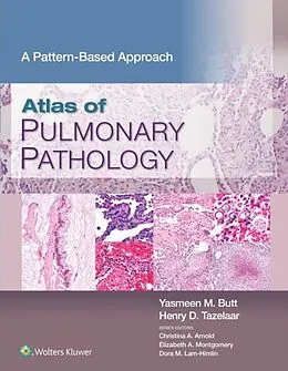 E-Book (epub) Atlas of Pulmonary Pathology von Yasmeen Mahmood Butt, Henry D. Tazelaar