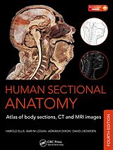 eBook (pdf) Human Sectional Anatomy de Adrian K. Dixon, David J. Bowden, Harold Ellis