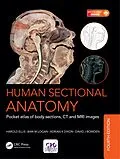 E-Book (pdf) Human Sectional Anatomy von Bari M. Logan, Harold Ellis, Adrian Kendal Dixon