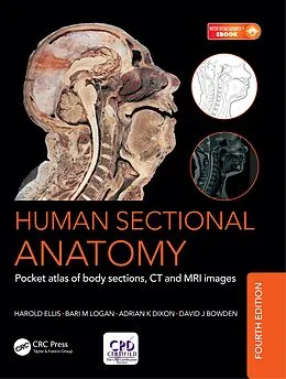 E-Book (pdf) Human Sectional Anatomy von Bari M. Logan, Harold Ellis, Adrian Kendal Dixon