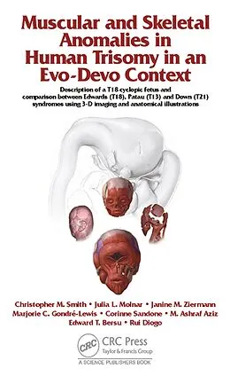 E-Book (pdf) Muscular and Skeletal Anomalies in Human Trisomy in an Evo-Devo Context von Rui Diogo, Christopher M. Smith, Janine M. Ziermann