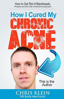 E-Book (epub) How I Cured My Chronic Acne: How to Get Rid of Blackheads, Pimples and Zits With a Nutritional Approach von Chris Klein