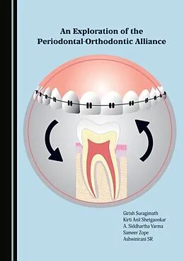 E-Book (pdf) Exploration of the Periodontal-Orthodontic Alliance von Girish Suragimath, Kirti Anil Shetgaonkar, A. Siddhartha Varma