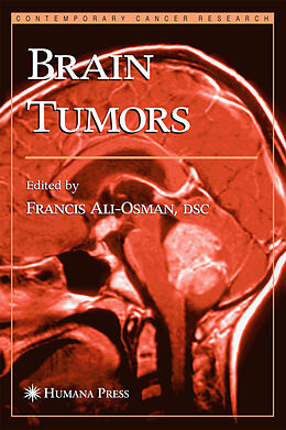 Livre Relié Brain Tumors de 