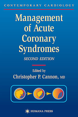 Fester Einband Management of Acute Coronary Syndromes von 