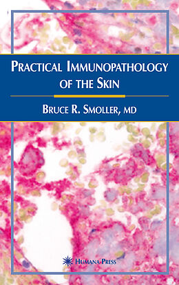 Livre Relié Practical Immunopathology of the Skin de Bruce R. Smoller