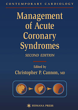 Kartonierter Einband Management of Acute Coronary Syndromes von 