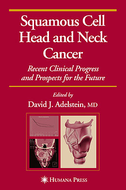 Fester Einband Squamous Cell Head and Neck Cancer von David J. Adelstein