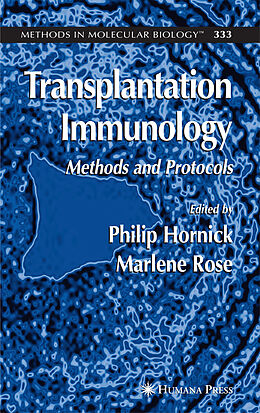 Fester Einband Transplantation Immunology von 