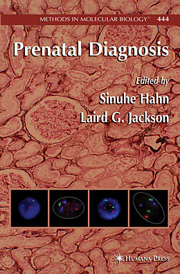 Fester Einband Prenatal Diagnosis von 