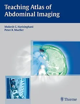 E-Book (pdf) Teaching Atlas of Abdominal Imaging von Mukesh G. Harisinghani, Peter R. Mueller