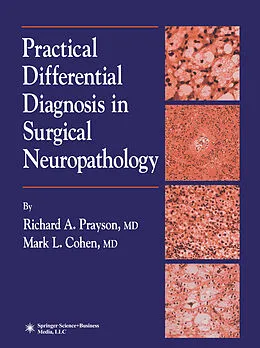 E-Book (pdf) Practical Differential Diagnosis in Surgical Neuropathology von Richard A. Prayson, Mark L. Cohen