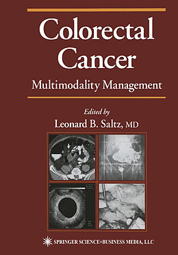 E-Book (pdf) Colorectal Cancer von 