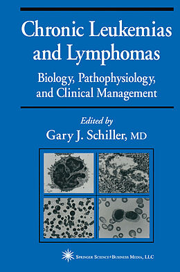 E-Book (pdf) Chronic Leukemias and Lymphomas von 