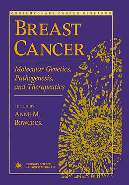 E-Book (pdf) Breast Cancer von 