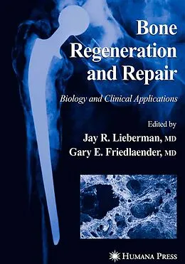 E-Book (pdf) Bone Regeneration and Repair von Jay R. Lieberman, Gary E. Friedlaender