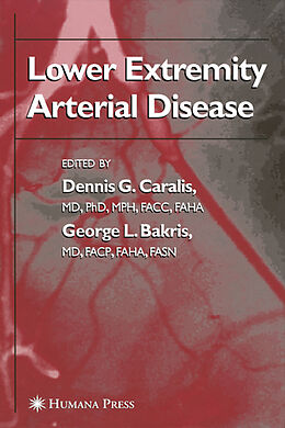 E-Book (pdf) Lower Extremity Arterial Disease von Dennis G. Caralis, George L. Bakris