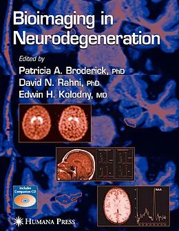 E-Book (pdf) Bioimaging in Neurodegeneration von Patricia A. Broderick, David N. Rahni, Edwin H. Kolodny