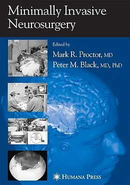 E-Book (pdf) Minimally Invasive Neurosurgery von Mark R. Proctor, Peter M. Black