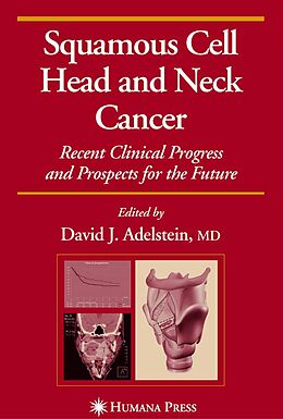 E-Book (pdf) Squamous Cell Head and Neck Cancer von David J. Adelstein