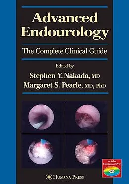 E-Book (pdf) Advanced Endourology von Stephen Y. Nakada, Margaret S. Pearle