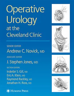 E-Book (pdf) Operative Urology von Andrew C. Novick, J. Stephen Jones, Inderbir S. Gill