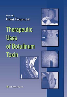 eBook (pdf) Therapeutic Uses of Botulinum Toxin de 