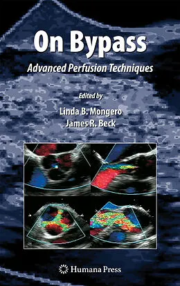 E-Book (pdf) On Bypass von L. B. Mongero, J. R. Beck
