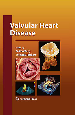 eBook (pdf) Valvular Heart Disease de Thomas M. Bashore, Andrew Wang
