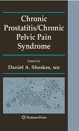 E-Book (pdf) Chronic Prostatitis/Chronic Pelvic Pain Syndrome von Daniel A. Shoskes
