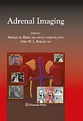 E-Book (pdf) Adrenal Imaging von Michael A. Blake, Giles W. L. Boland