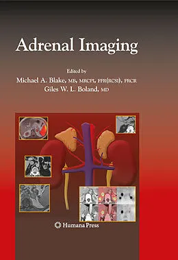 E-Book (pdf) Adrenal Imaging von Michael A. Blake, Giles W. L. Boland