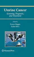 E-Book (pdf) Uterine Cancer von Esther Oliva, Franco Muggia