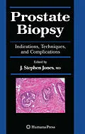 E-Book (pdf) Prostate Biopsy von J. Stephen Jones
