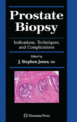 E-Book (pdf) Prostate Biopsy von J. Stephen Jones