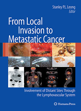 Fester Einband From Local Invasion to Metastatic Cancer von 