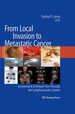 E-Book (pdf) From Local Invasion to Metastatic Cancer von Stanley P. L. Leong