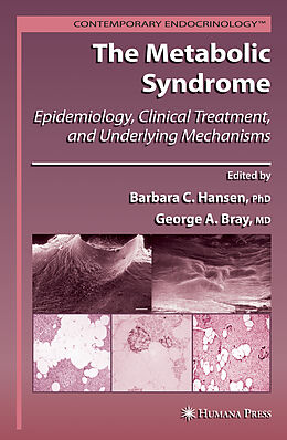 eBook (pdf) The Metabolic Syndrome: de 