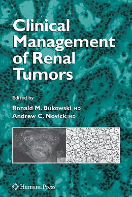 E-Book (pdf) Clinical Management of Renal Tumors von Ronald M. Bukowski, Andrew Novick