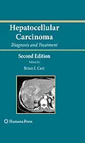 E-Book (pdf) Hepatocellular Carcinoma von Brian I. Carr