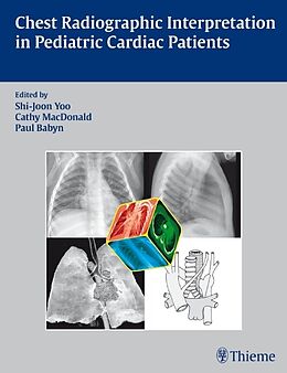 Fester Einband Chest Radiographic Interpretation in Pediatric Cardiac Patients von Shi-Joon Yoo, Cathy MacDonald, Paul Babyn
