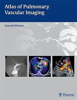 E-Book (epub) Atlas of Pulmonary Vascular Imaging von Conrad Wittram
