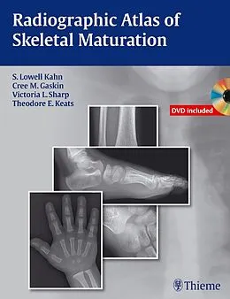 E-Book (pdf) Radiographic Atlas of Skeletal Maturation von S. Lowell Kahn, Christopher M. Gaskin, Victoria L. Sharp