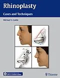 E-Book (pdf) Rhinoplasty von Michael S. Godin