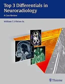 E-Book (pdf) Top 3 Differentials in Neuroradiology von William T. O'Brien