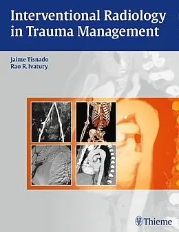 E-Book (pdf) Interventional Radiology in Trauma Management von Jaime Tisnado, Rao R Ivatury
