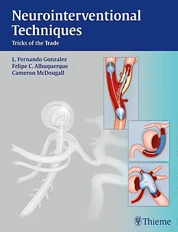 E-Book (pdf) Neurointerventional Techniques von Fernando Gonzalez, Felipe Albuquerque, Cameron G. Mcdougall